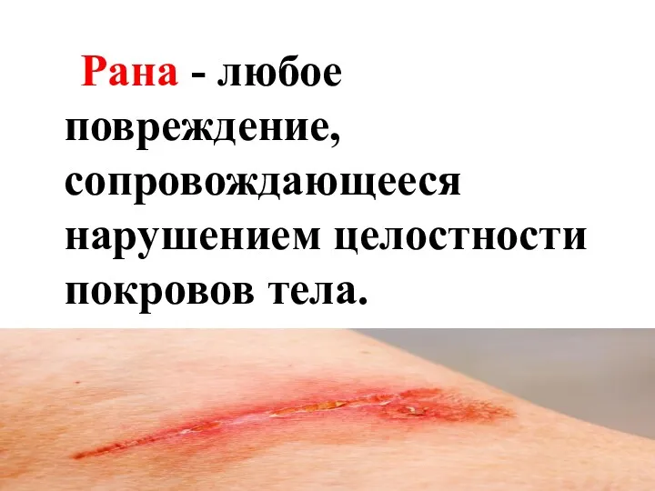 Рана - любое повреждение, сопровождающееся нарушением целостности покровов тела.