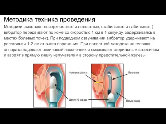 Методика техника проведения Методики выделяют поверхностные и полостные, стабильные и