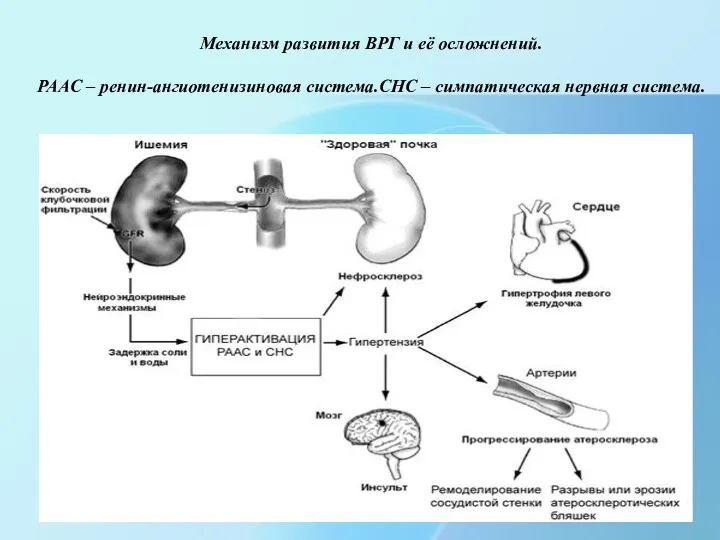 Механизм развития ВРГ и её осложнений. РААС – ренин-ангиотенизиновая система.СНС – симпатическая нервная система.