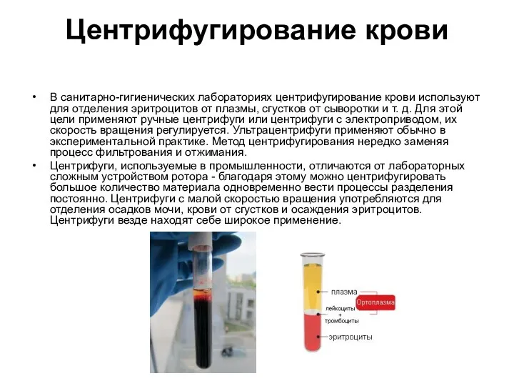 Центрифугирование крови В санитарно-гигиенических лабораториях центрифугирование крови используют для отделения