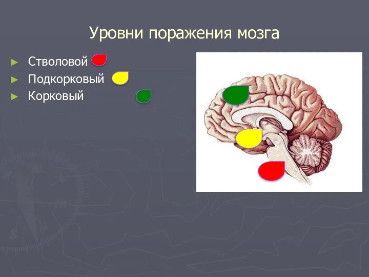 Уровни поражения мозга Стволовой Подкорковый Корковый