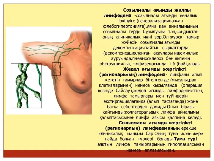 Созылмалы ағымды жалпы лимфедема -созылмалы ағымды веналық іркілуіге (генерализацияланған флебогипертонияға),яғни