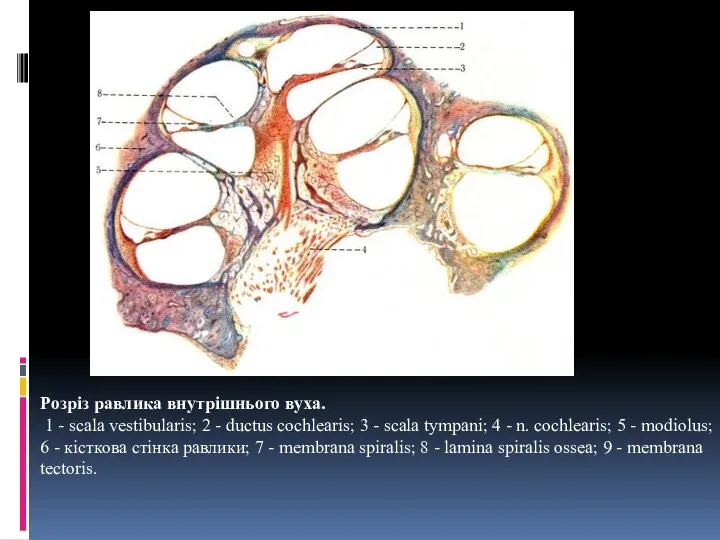 Розріз равлика внутрішнього вуха. 1 - scala vestibularis; 2 - ductus cochlearis; 3