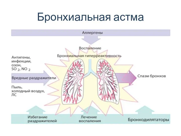 Бронхиальная астма