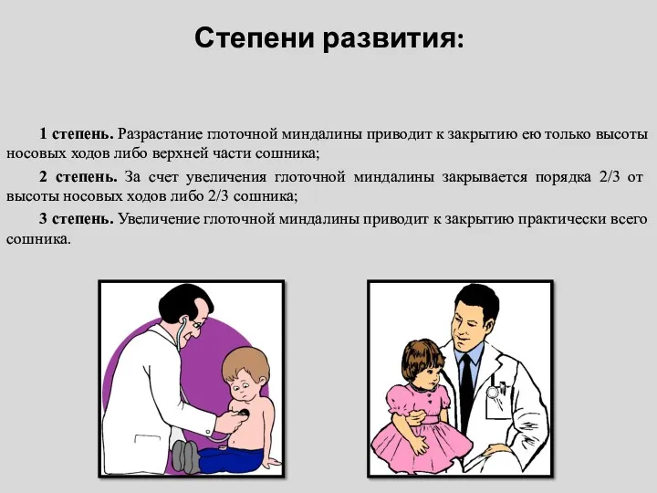 Степени развития: 1 степень. Разрастание глоточной миндалины приводит к закрытию