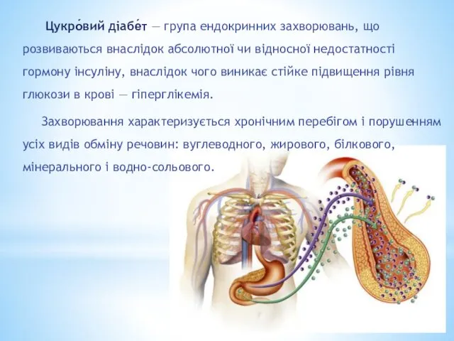 Цукро́вий діабе́т — група ендокринних захворювань, що розвиваються внаслідок абсолютної чи відносної недостатності