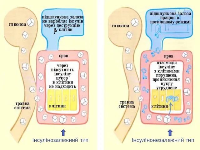 Інсулінозалежний тип Інсулінонезалежний тип