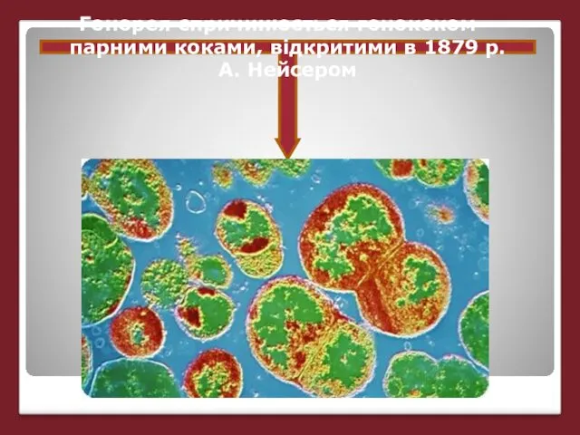 Гонорея спричинюється гонококом – парними коками, відкритими в 1879 р. А. Нейсером