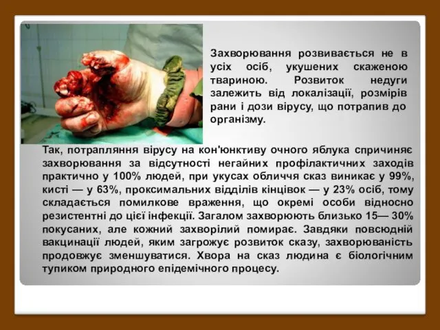 Захворювання розвивається не в усіх осіб, укушених скаженою твариною. Розвиток