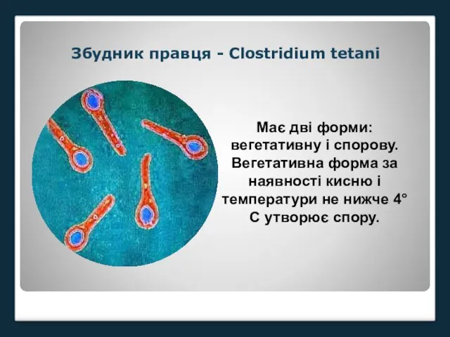 Збудник правця - Clostridium tetani Має дві форми: вегетативну і