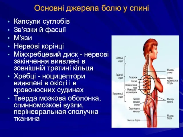 Основні джерела болю у спині Капсули суглобів Зв'язки й фасції М'язи Нервові корінці