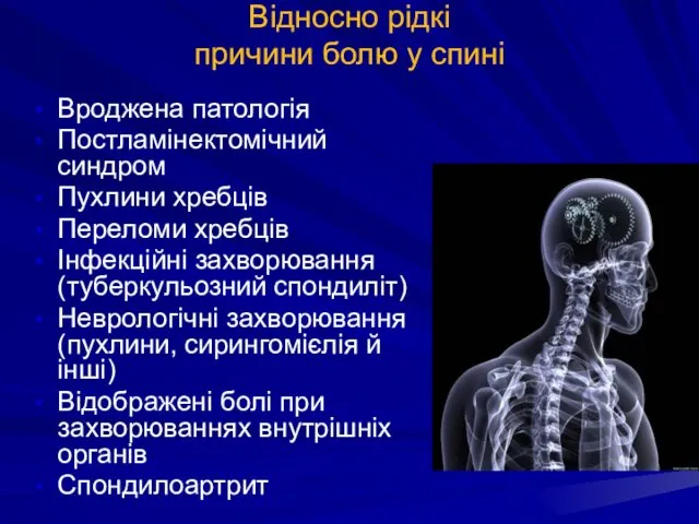 Відносно рідкі причини болю у спині Вроджена патологія Постламінектомічний синдром Пухлини хребців Переломи