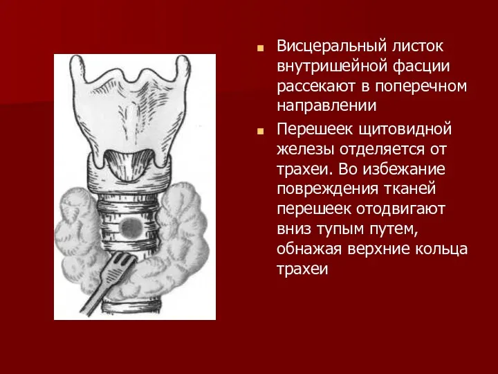 Висцеральный листок внутришейной фасции рассекают в поперечном направлении Перешеек щитовидной