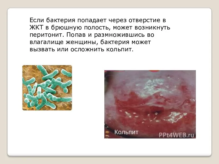 Если бактерия попадает через отверстие в ЖКТ в брюшную полость, может возникнуть перитонит.
