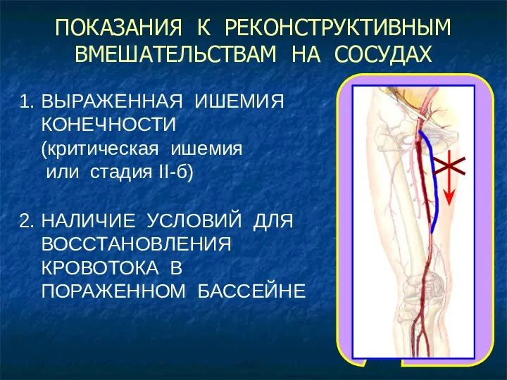 ПОКАЗАНИЯ К РЕКОНСТРУКТИВНЫМ ВМЕШАТЕЛЬСТВАМ НА СОСУДАХ 1. ВЫРАЖЕННАЯ ИШЕМИЯ КОНЕЧНОСТИ