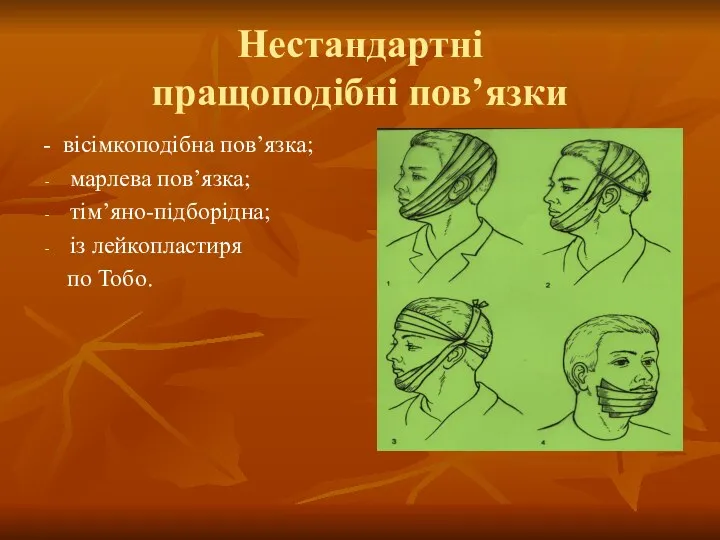 Нестандартні пращоподібні пов’язки - вісімкоподібна пов’язка; марлева пов’язка; тім’яно-підборідна; із лейкопластиря по Тобо.