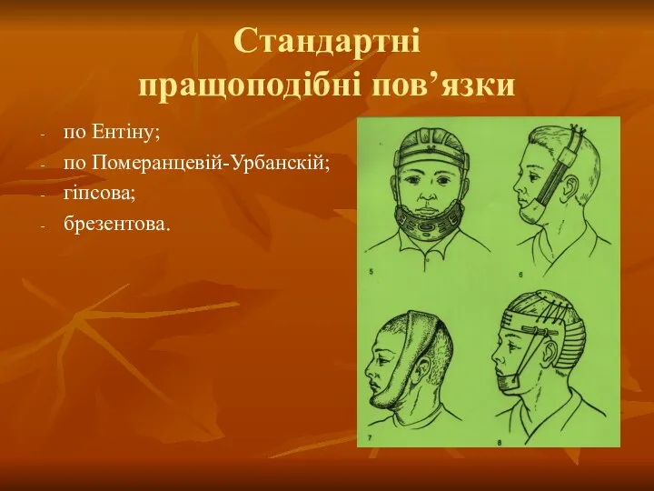 Стандартні пращоподібні пов’язки по Ентіну; по Померанцевій-Урбанскій; гіпсова; брезентова.