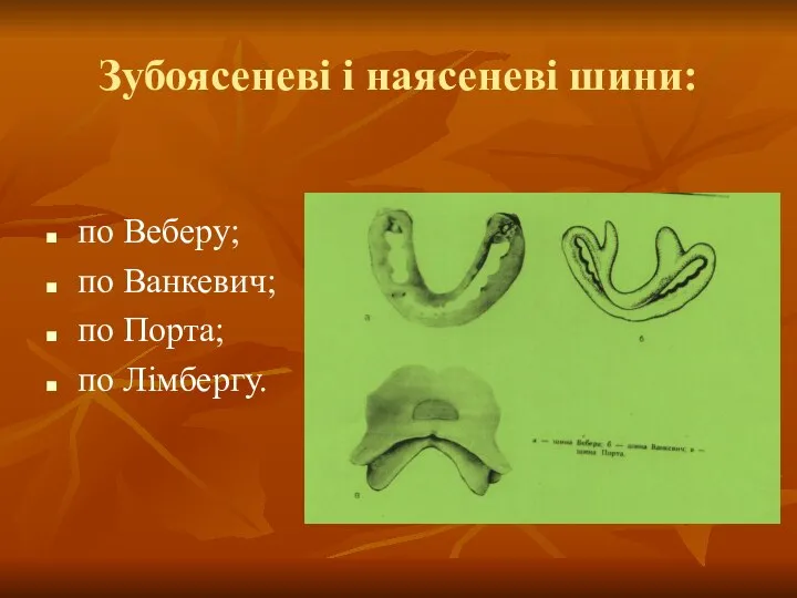 Зубоясеневі і наясеневі шини: по Веберу; по Ванкевич; по Порта; по Лімбергу.