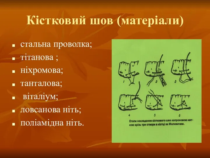 Кістковий шов (матеріали) стальна проволка; тітанова ; ніхромова; танталова; віталіум; ловсанова ніть; поліамідна ніть.