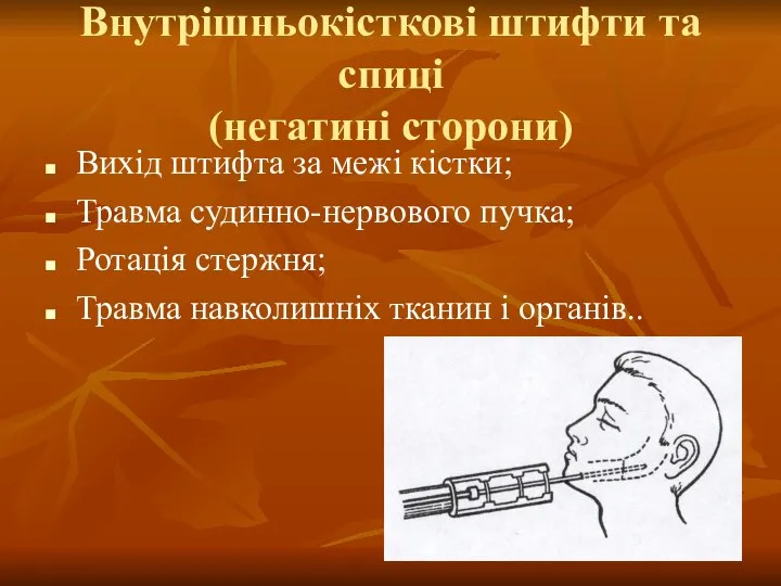 Внутрішньокісткові штифти та спиці (негатині сторони) Вихід штифта за межі