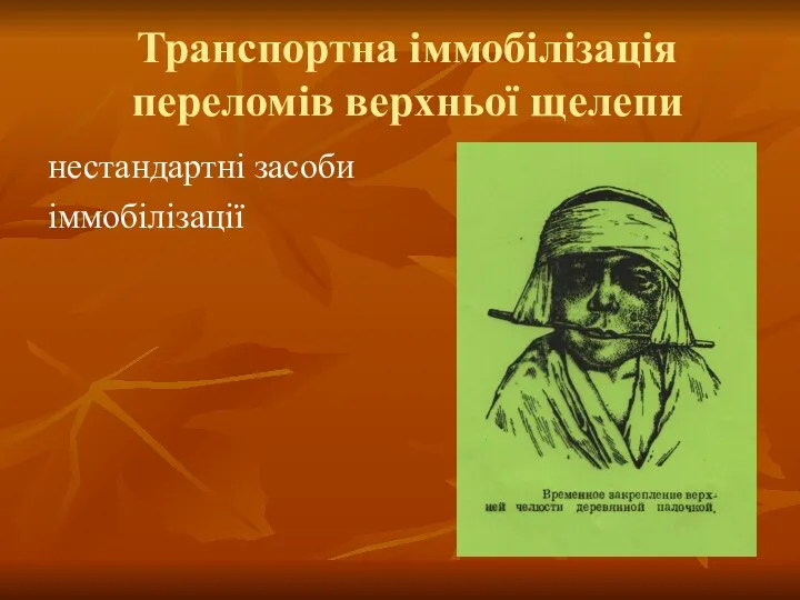 Транспортна іммобілізація переломів верхньої щелепи нестандартні засоби іммобілізації