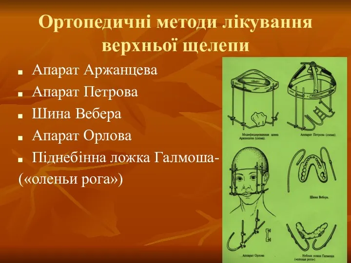 Ортопедичні методи лікування верхньої щелепи Апарат Аржанцева Апарат Петрова Шина