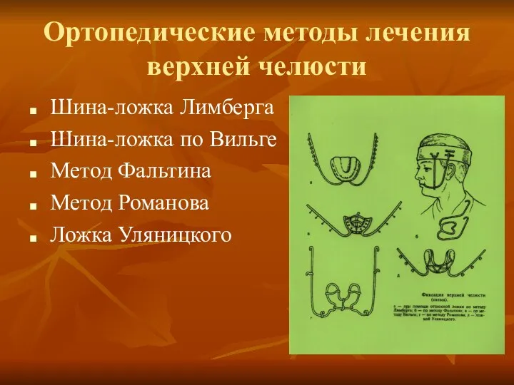 Ортопедические методы лечения верхней челюсти Шина-ложка Лимберга Шина-ложка по Вильге Метод Фальтина Метод Романова Ложка Уляницкого