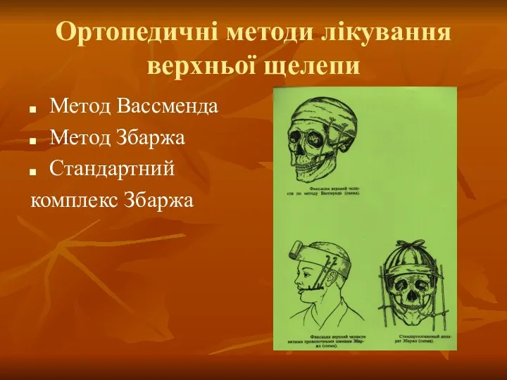 Ортопедичні методи лікування верхньої щелепи Метод Вассменда Метод Збаржа Стандартний комплекс Збаржа