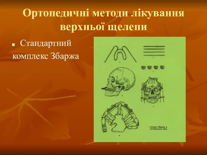 Ортопедичні методи лікування верхньої щелепи Стандартний комплекс Збаржа