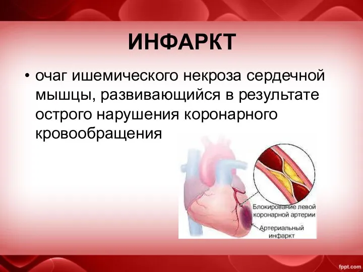 ИНФАРКТ очаг ишемического некроза сердечной мышцы, развивающийся в результате острого нарушения коронарного кровообращения