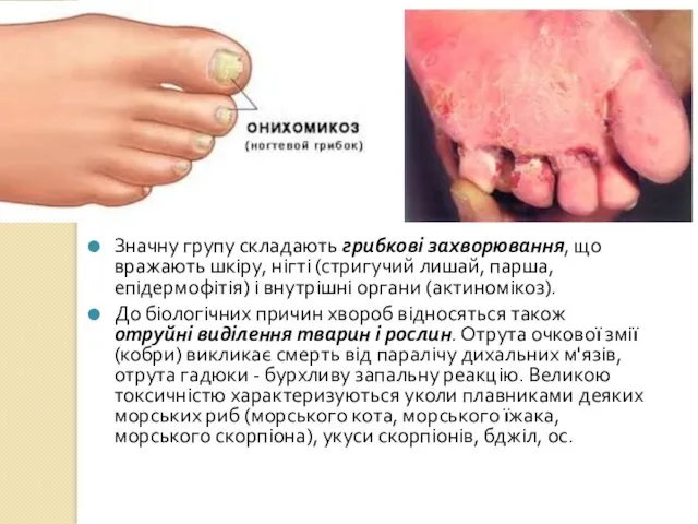 Значну групу складають грибкові захворювання, що вражають шкіру, нігті (стригучий
