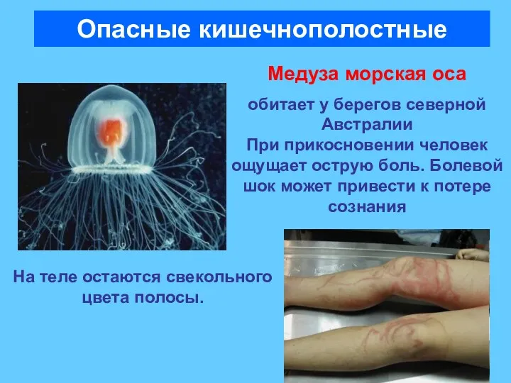 Опасные кишечнополостные Медуза морская оса обитает у берегов северной Австралии При прикосновении человек