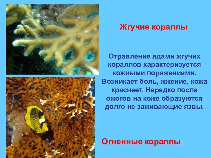 Отравление ядами жгучих кораллов характеризуется кожными поражениями. Возникает боль, жжение, кожа краснеет. Нередко