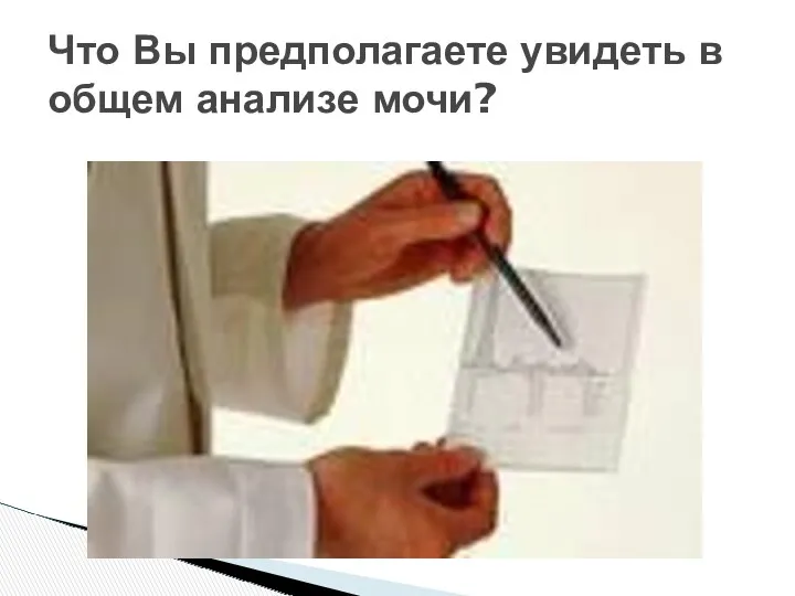 Что Вы предполагаете увидеть в общем анализе мочи?