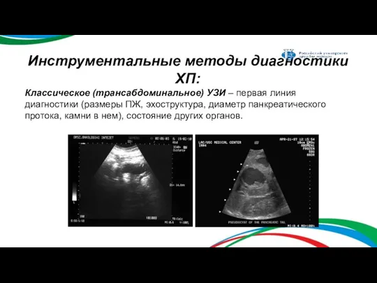 Инструментальные методы диагностики ХП: Классическое (трансабдоминальное) УЗИ – первая линия