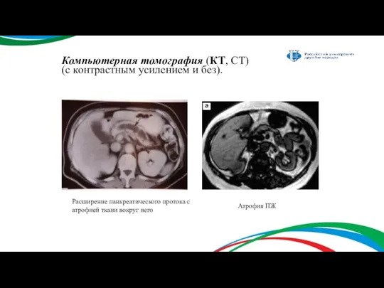 Компьютерная томография (КТ, СТ) (с контрастным усилением и без). Расширение