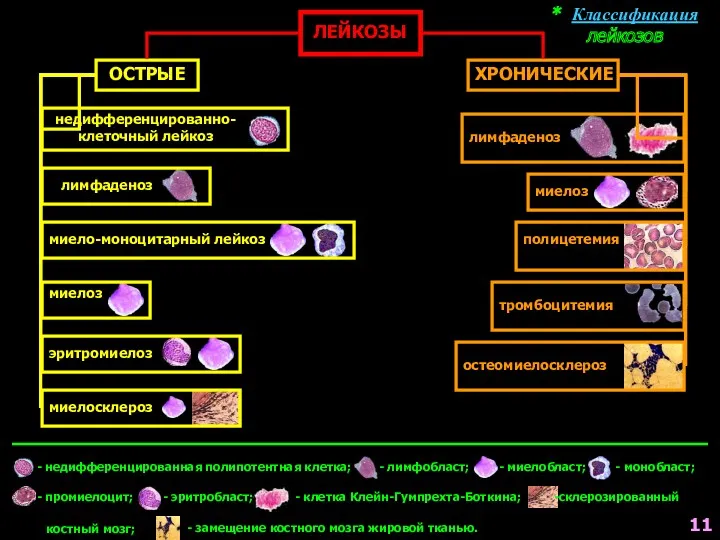 * Классификация лейкозов ЛЕЙКОЗЫ ОСТРЫЕ ХРОНИЧЕСКИЕ недифференцированно- клеточный лейкоз лимфаденоз