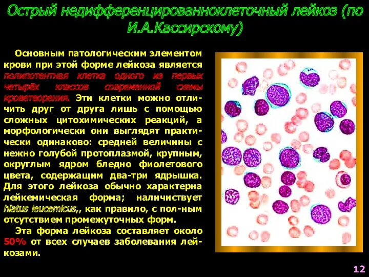 Острый недифференцированноклеточный лейкоз (по И.А.Кассирскому) Основным патологическим элементом крови при