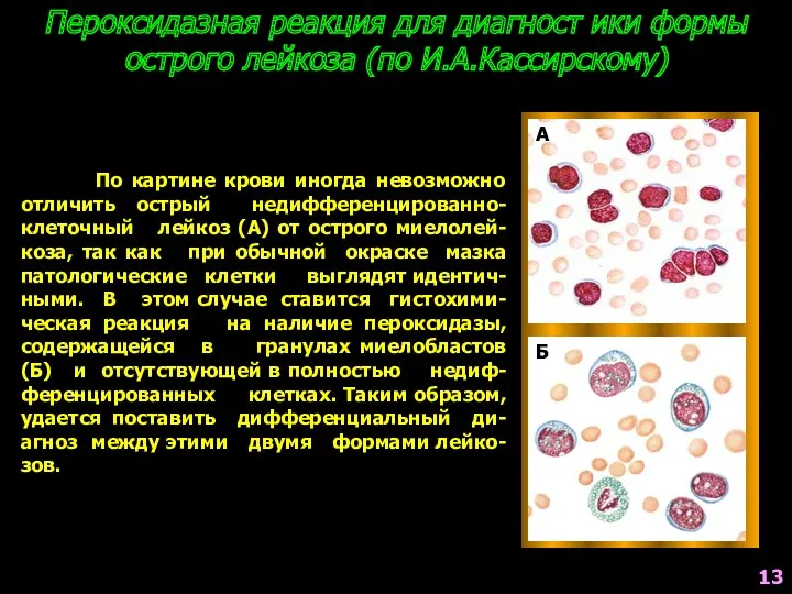 Пероксидазная реакция для диагност ики формы острого лейкоза (по И.А.Кассирскому)