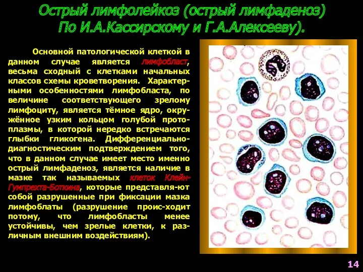 Основной патологической клеткой в данном случае является лимфобласт, весьма сходный