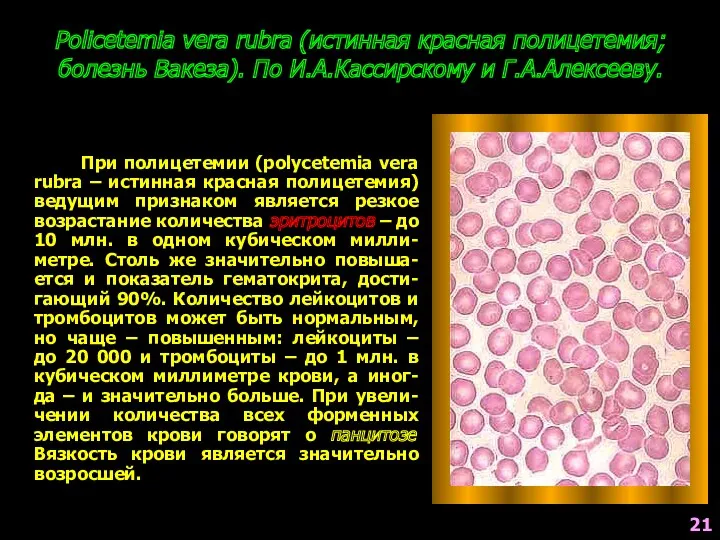 Policetemia vera rubra (истинная красная полицетемия; болезнь Вакеза). По И.А.Кассирскому