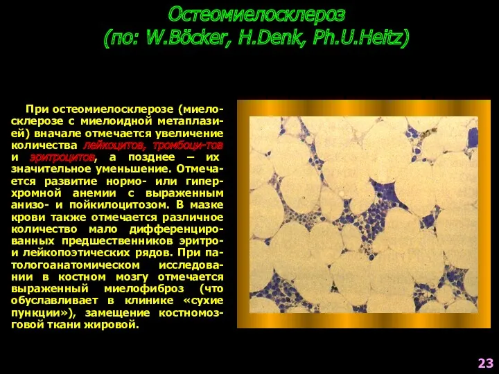 Остеомиелосклероз (по: W.Böcker, H.Denk, Ph.U.Heitz) При остеомиелосклерозе (миело-склерозе с миелоидной