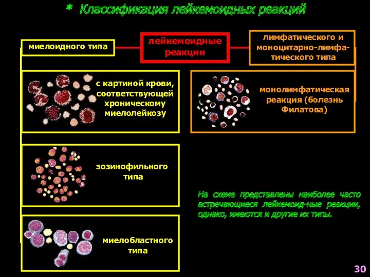 * Классификация лейкемоидных реакций лейкемоидные реакции миелоидного типа лимфатического и