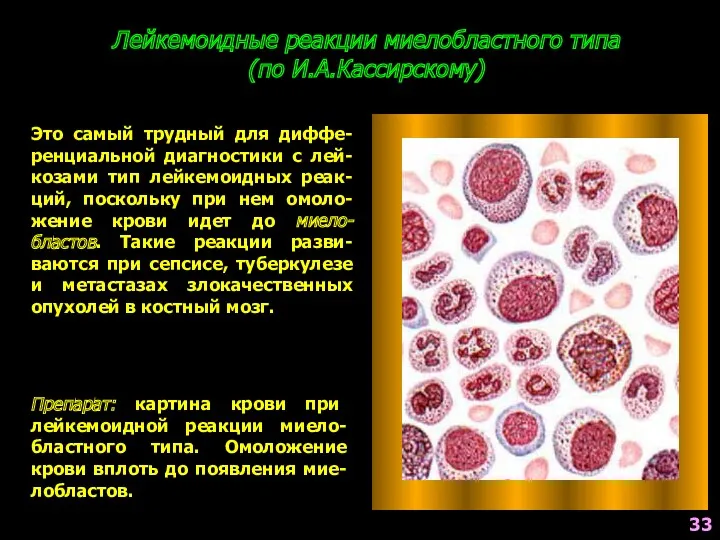 Лейкемоидные реакции миелобластного типа (по И.А.Кассирскому) Это самый трудный для