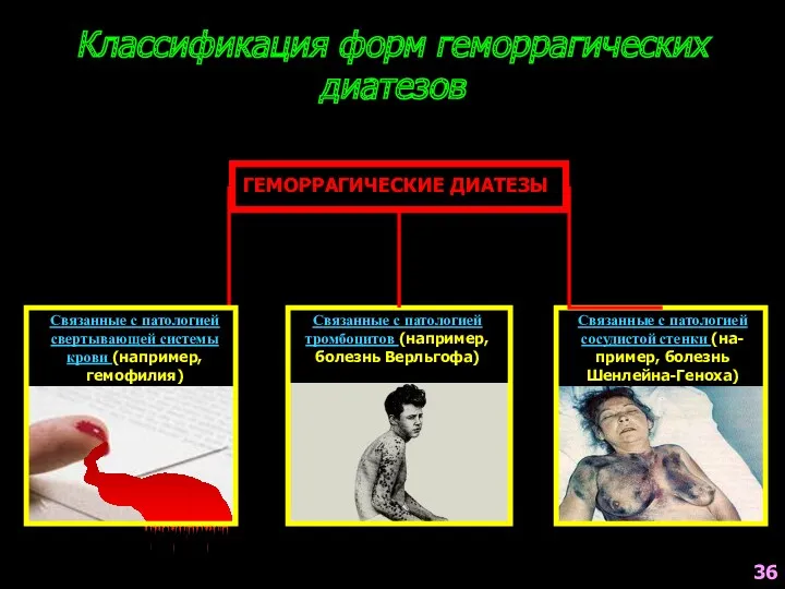 Связанные с патологией свертывающей системы крови (например, гемофилия) Связанные с