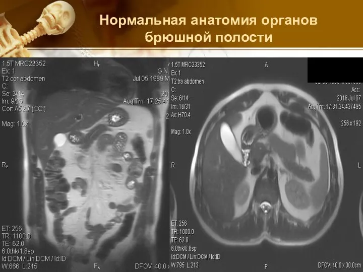 Нормальная анатомия органов брюшной полости