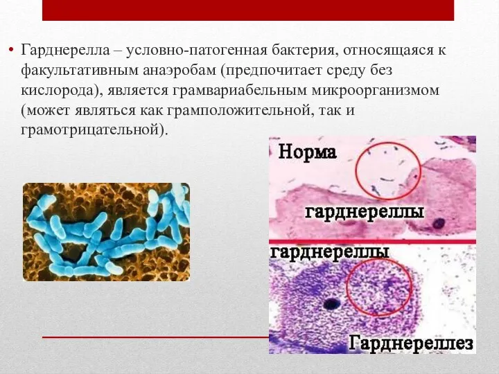 Гарднерелла – условно-патогенная бактерия, относящаяся к факультативным анаэробам (предпочитает среду