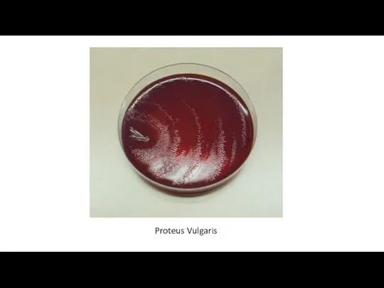 Proteus Vulgaris