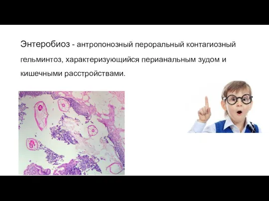 Энтеробиоз - антропонозный пероральный контагиозный гельминтоз, характеризующийся перианальным зудом и кишечными расстройствами.