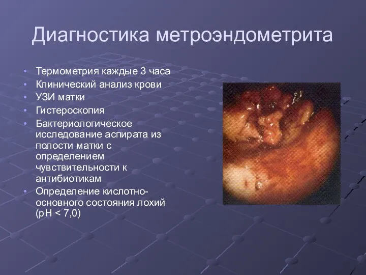 Диагностика метроэндометрита Термометрия каждые 3 часа Клинический анализ крови УЗИ